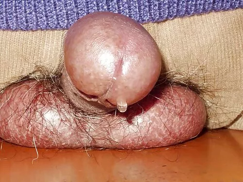الإباحية ذات الأرجل  ...